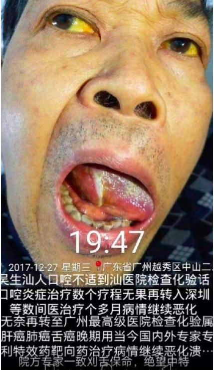 现代医疗手段与古代中医文化》 一一 疗效才是硬道理一一