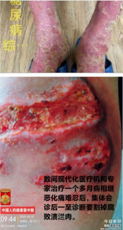 现代医疗手段与古代中医文化》 一一 疗效才是硬道理一一